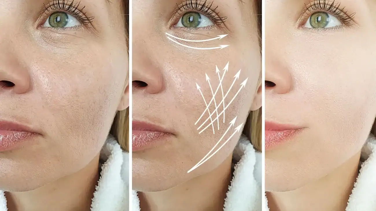 Can One Treatment Really Tackle More Than One Skin Concern Hungerford?