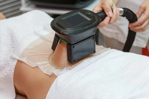 Image of person having fat freezing treatment to help weight gain Hungerford