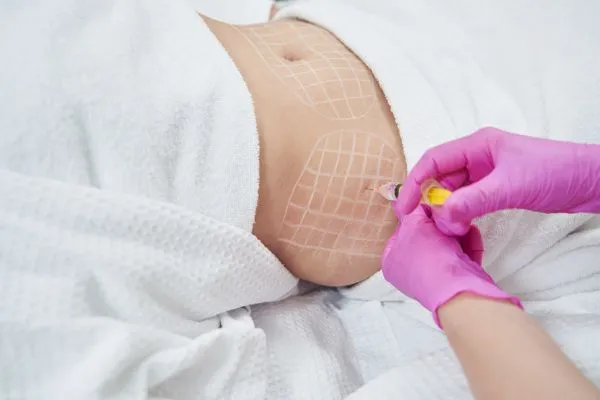 image of fat dissolving injections on love handles to help combat weight gain Hungerford