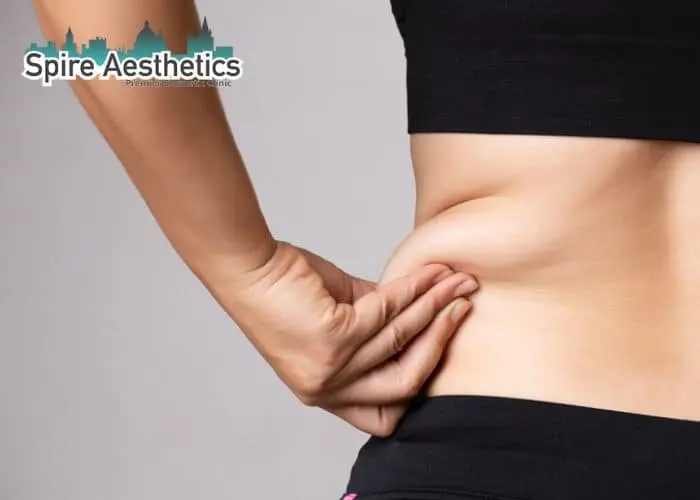 Image of woman pinching fat on their hips Hungerford. Fat Freezing treatment