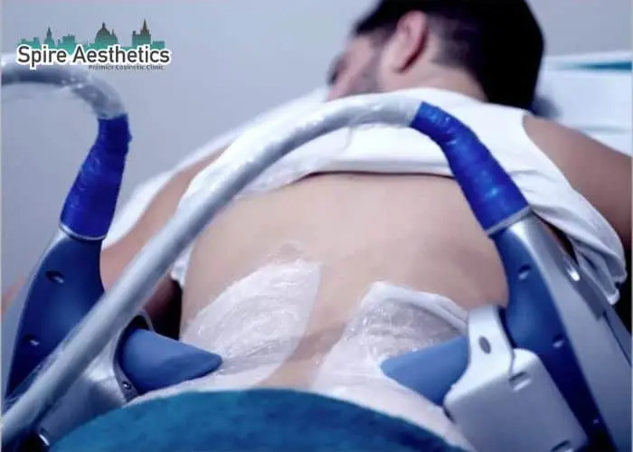 Man having fat freezing treatment done on love handles before a competitions Hungerford to create a sculpted look.