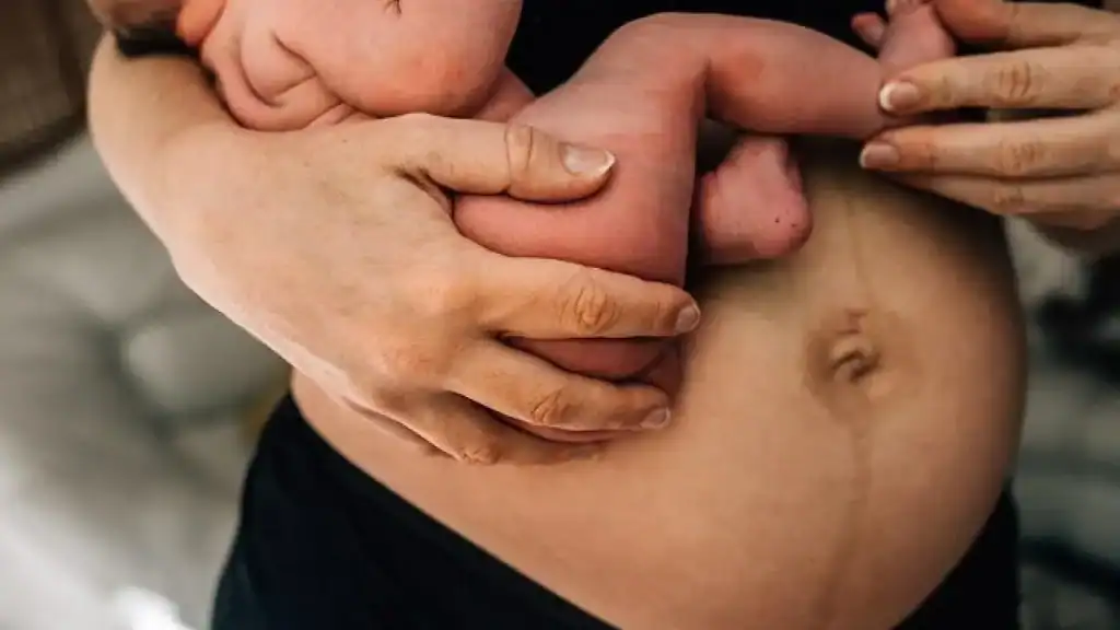 Why Is My Stomach Still Big After Pregnancy Hungerford?